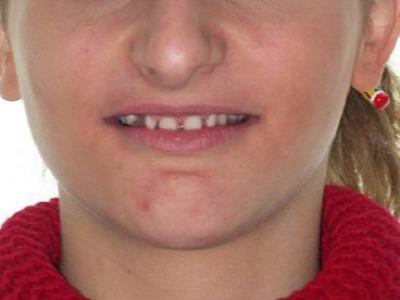 Πριν